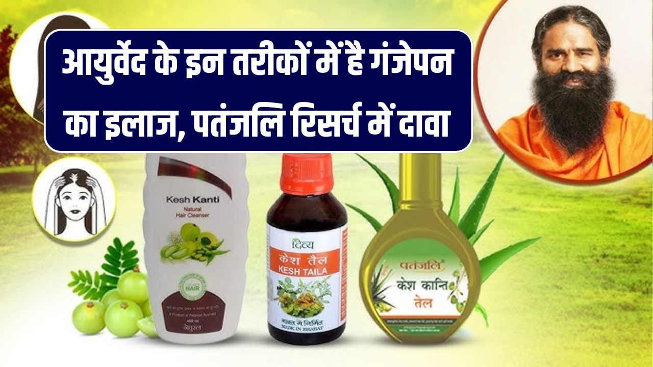 Ayurvedic Hair Loss Treatment: गंजेपन का रामबाण इलाज मिला! पतंजलि रिसर्च में आयुर्वेद से चौंकाने वाला दावा