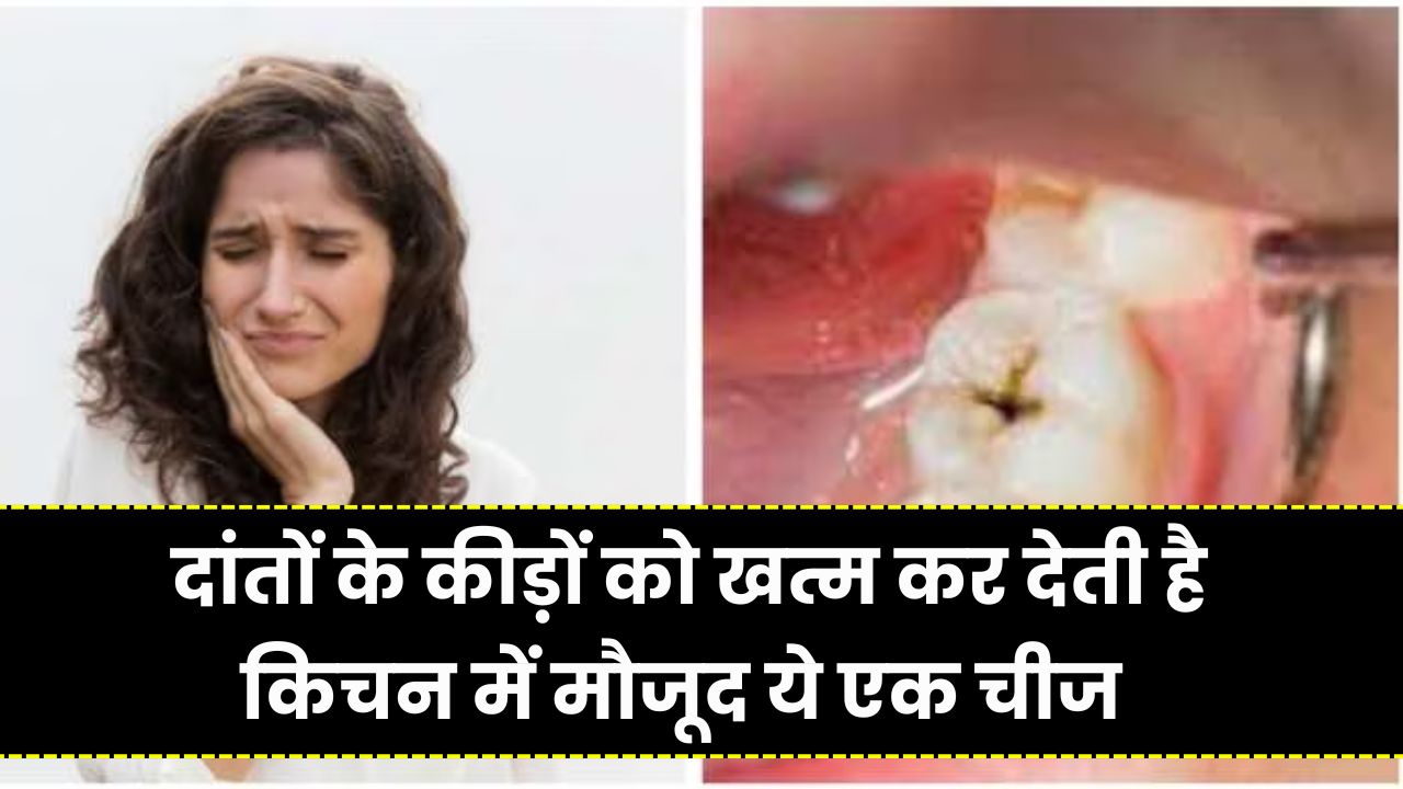 Teeth Cavity Home Remedy: किचन में मौजूद ये चीज दांतों का कीड़ा खत्म करने का है रामबाण इलाज, मिलेगा चौंकाने वाला फायदा